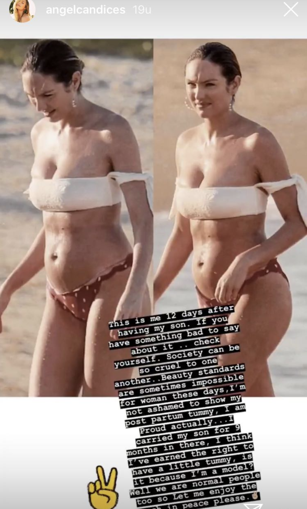 Wereldwijd struik Botanist Kritiek op Victoria's Secret model omdat ze na bevalling nog zwanger lijkt:  'Ik heb een buikje'